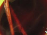 ���� �����������